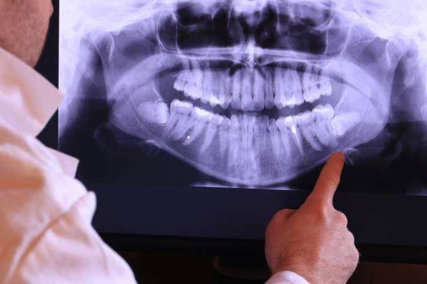Best Broken or Cracked Tooth Emergency Dentist in North Amityville, NY